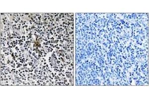 Immunohistochemistry (IHC) image for anti-Ribosomal Protein S3 (RPS3) (AA 171-220) antibody (ABIN2890066) (RPS3 抗体  (AA 171-220))