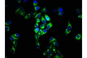 Immunofluorescence staining of Hela cells with ABIN7152658 at 1:33, counter-stained with DAPI.