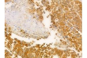 ABIN6262986 and ABIN6278409 at 1/100 staining human normal kidney tissue by IHC-P.