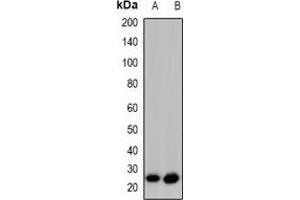 Western blot analysis of GAP43 (pS41) expression in HeLa PMA-treated (A), SHSY5Y (B) whole cell lysates. (GAP43 抗体  (N-Term, pSer41))