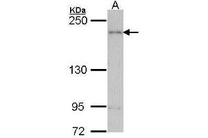 Western Blotting (WB) image for anti-ArfGAP with RhoGAP Domain, Ankyrin Repeat and PH Domain 1 (ARAP1) (C-Term) antibody (ABIN2856313)