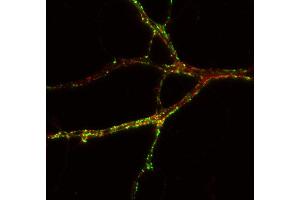 Indirect immunostaining of PFA fixed rat hippocampus neurons with anti-TNiK (dilution 1 : 500; red) and mouse anti-synapsin 1 (cat. (TNIK 抗体)
