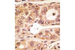 Image no. 1 for anti-Toll-Like Receptor 5 (TLR5) (C-Term) antibody (ABIN357052) (TLR5 抗体  (C-Term))