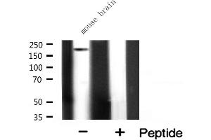 Western blot analysis on mouse brain lysate using ALPK2 Antibody. (ALPK2 抗体  (Internal Region))