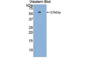 Western Blotting (WB) image for anti-HSPA Binding Protein, Cytoplasmic Cochaperone 1 (HSPBP1) (AA 136-354) antibody (ABIN1176143) (HSPBP1 抗体  (AA 136-354))