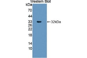 Detection of Recombinant RSPO3, Human using Polyclonal Antibody to R-Spondin 3 (RSPO3) (R-Spondin 3 抗体  (AA 22-272))