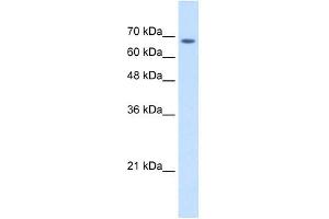 TM9SF1 antibody used at 2. (TM9SF1 抗体  (Middle Region))