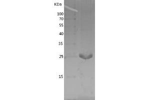 Western Blotting (WB) image for Aprataxin (APTX) (AA 180-356) protein (His tag) (ABIN7121877) (Aprataxin Protein (APTX) (AA 180-356) (His tag))