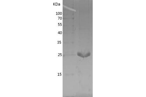 Aprataxin Protein (APTX) (AA 180-356) (His tag)
