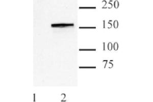 Cas9 antibody (mAb) tested by Western blot. (CRISPR-Cas9 (N-Term) 抗体)