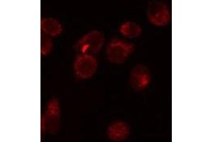 Immunofluorescence (fixed cells) (IF/ICC) image for anti-Epithelial Cell Adhesion Molecule (EPCAM) (Internal Region) antibody (ABIN6265433)