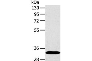 Western Blot analysis of Human fetal liver tissue using SULT2A1 Polyclonal Antibody at dilution of 1:650 (SULT2A1 抗体)