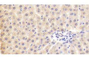 Detection of PLA2G3 in Rat Liver Tissue using Polyclonal Antibody to Phospholipase A2, Group III (PLA2G3) (PLA2G3 抗体  (AA 20-268))
