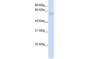 ND5 antibody used at 1 ug/ml to detect target protein. (MT-ND5 抗体)