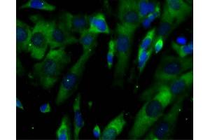 Immunofluorescent staining of SH-SY5Y cells (right). (Ataxin 2 抗体  (AA 713-904))