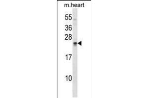 Western blot analysis in mouse heart tissue lysates (35ug/lane). (SOSTDC1 抗体  (C-Term))