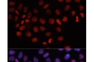 Immunofluorescence analysis of HeLa cells using RCC1 Polyclonal Antibody at dilution of 1:100. (RCC1 抗体)