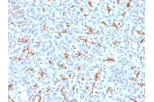 Formalin-fixed, paraffin-embedded human Pancreas stained with CFTR Rabbit Polyclonal Antibody.