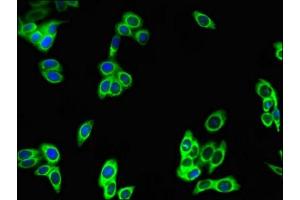 Immunofluorescent analysis of HepG2 cells using ABIN7163181 at dilution of 1:100 and Alexa Fluor 488-congugated AffiniPure Goat Anti-Rabbit IgG(H+L) (PREX2 抗体  (AA 1417-1592))