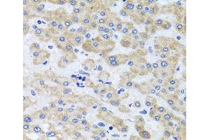 Immunohistochemistry of paraffin-embedded Human liver damage using PEX3 Polyclonal Antibody at dilution of 1:100 (40x lens). (PEX3 抗体)