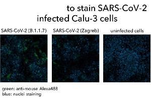 Calu-3 cells were infected with SARS-CoV-2 (B. (Recombinant SARS-CoV-2 Spike 抗体  (AA 319-541))