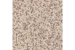 IHC analysis of SNRNP40 using anti-SNRNP40 antibody (ABIN7601719). (SNRNP40 抗体  (AA 43-357))