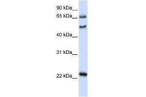 WB Suggested Anti-UNCX Antibody Titration:  0. (UNCX 抗体  (N-Term))