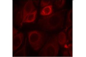 Image no. 1 for anti-Receptor Tyrosine-Protein Kinase ErbB-3 (ERBB3) (pTyr1328) antibody (ABIN319274) (ERBB3 抗体  (pTyr1328))