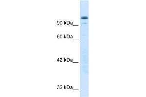 WB Suggested Anti-GTF2I Antibody Titration:  0. (GTF2I 抗体  (N-Term))
