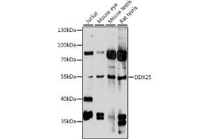 Western blot analysis of extracts of various cell lines, using DDX25 antibody (ABIN7266692) at 1:1000 dilution. (DDX25 抗体  (AA 284-483))