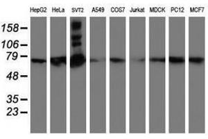 Image no. 2 for anti-SAM Domain and HD Domain 1 (SAMHD1) antibody (ABIN1500798) (SAMHD1 抗体)