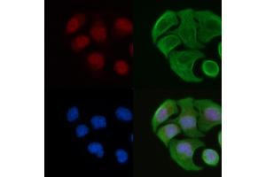 ABIN6264342 and ABIN6277090 staining Hela cells by IF/ICC. (POLR2A/RPB1 抗体  (Internal Region))