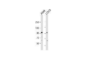 All lanes : Anti-EPS8 Antibody (N-term) at 1:2000 dilution Lane 1: A549 whole cell lysate Lane 2: LOVO whole cell lysate Lysates/proteins at 20 μg per lane. (EPS8 抗体  (N-Term))