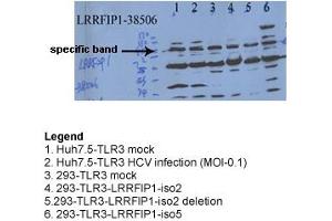 Sample Type: Hepatitis C Virus & 293 TransfectionsPrimary Dilution: 1ug/mL (LRRFIP1 抗体  (N-Term))