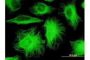 Immunofluorescence of monoclonal antibody to TUBB2A on HeLa cell. (TUBB2A 抗体  (AA 1-445))