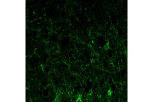 Immunofluorescence analysis of paraffin-embedded lobe of brain tissues using GFAP mouse mAb (green). (GFAP 抗体)