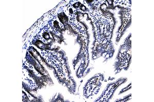 Immunohistochemistry (IHC) image for anti-Chromobox Homolog 3 (CBX3) (AA 2-183) antibody (ABIN5693033)