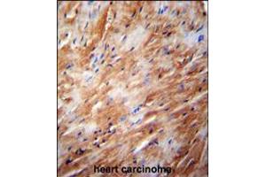 TFB2M Antibody immunohistochemistry analysis in formalin fixed and paraffin embedded human heart carcinoma followed by peroxidase conjugation of the secondary antibody and DAB staining. (TFB2M 抗体  (C-Term))