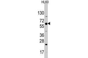Western blot analysis of SLC2A2 polyclonal antibody  in HL-60 cell line lysates (35 ug/lane). (SLC2A2 抗体  (N-Term))