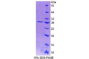 SDS-PAGE analysis of Human Sp17 Protein. (SPA17 蛋白)