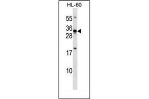 Western blot analysis of HOXB8 / HOX2D Antibody (C-term) in HL-60 cell line lysates (35ug/lane). (HOXB8 抗体  (C-Term))