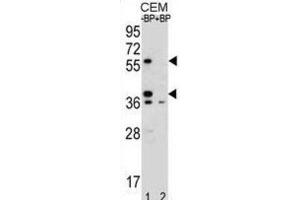 Western Blotting (WB) image for anti-Myeloid Cell Nuclear Differentiation Antigen (MNDA) antibody (ABIN2996101) (MNDA 抗体)