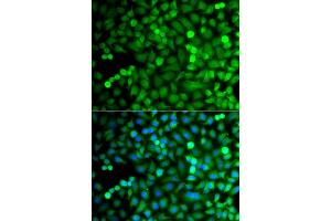 Immunofluorescence analysis of A549 cell using OSGEP antibody.