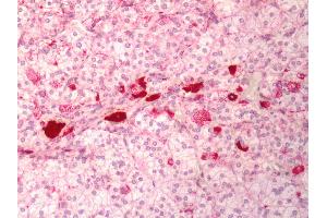 Human Adrenal: Formalin-Fixed, Paraffin-Embedded (FFPE) (MC1 Receptor 抗体  (Cytoplasmic Domain))
