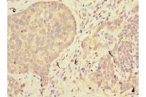 Immunohistochemistry (IHC) image for anti-Abhydrolase Domain Containing 2 (ABHD2) (AA 31-320) antibody (ABIN7160145)