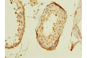 Immunohistochemistry of paraffin-embedded human testis tissue using ABIN7176433 at dilution of 1:100 (ZNF614 抗体  (AA 1-198))