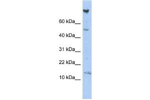 WB Suggested Anti-NRARP Antibody Titration: 0.