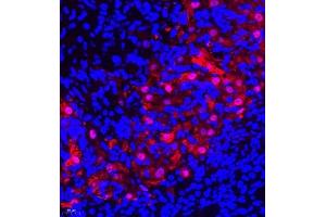 Immunofluorescence of paraffin embedded rat ovary using SLC7A8 (ABIN7074503) at dilution of 1:300 (400x lens) (LAT2 抗体)