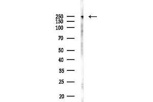 Western blot analysis of lysates from Hela cells(LPS 4h treatment), using CCDC88C Antibody at 1/1000 dilution.