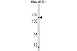 Western blot analysis of TBC1D4 Antibody (N-term) in MDA-MB231 cell line lysates (35ug/lane). (TBC1D4 抗体  (N-Term))